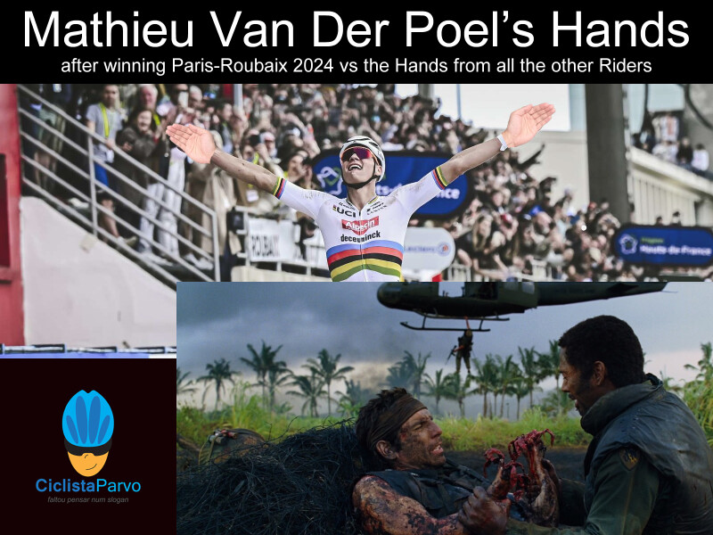 Mathieu Van Der Poel’s Hands after winning Paris-Roubaix 2024 vs the Hands from all the other Riders